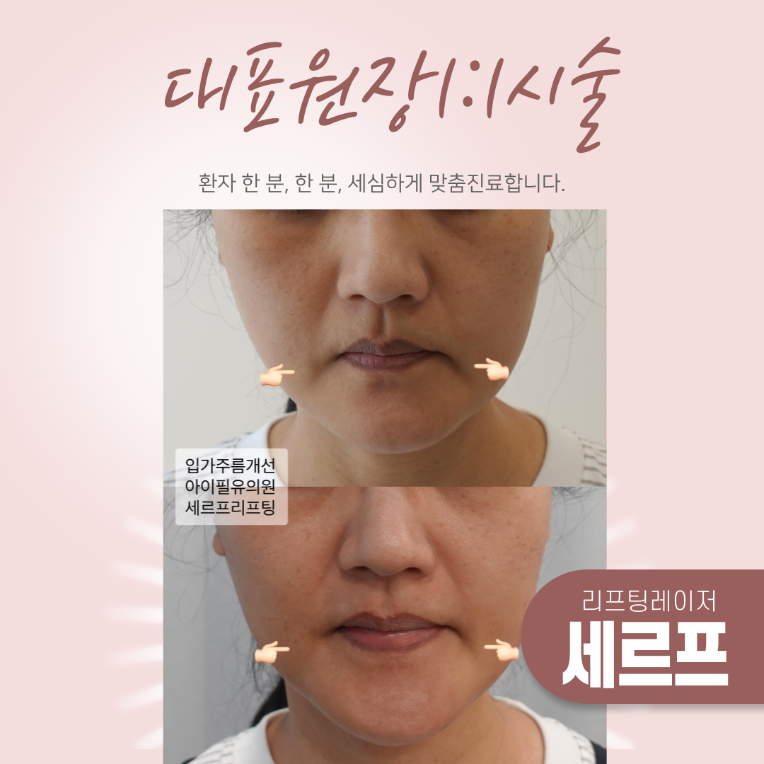 대표원장1:1시술