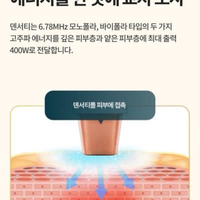 눈가주름 심해질 때 , 덴서티하이 아이, 아이리쥬란 , 보톡스 , 덴서티하이 아이 효과, 원리, 유지기간
